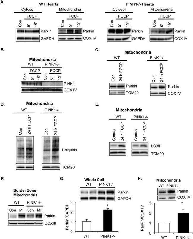 MTCO1 Antibody in Western Blot (WB)