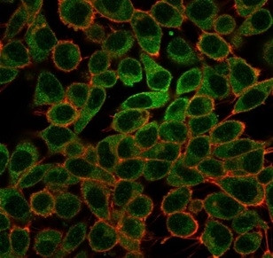 L-Myc/MYCL1 (Transcription Factor) Antibody in Immunocytochemistry (ICC/IF)