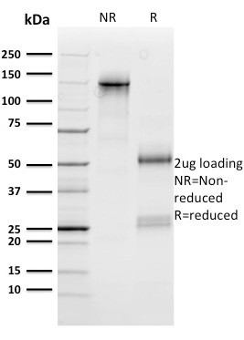 n-Myc (Neuroblastoma Marker) Antibody in SDS-PAGE (SDS-PAGE)