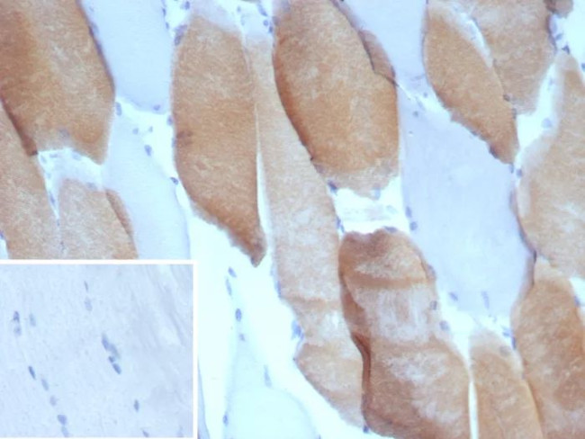 MYH7 Antibody in Immunohistochemistry (Paraffin) (IHC (P))