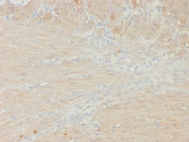 Smooth Muscle Myosin Heavy Chain (SM-MHC) (Leiomyosarcoma and Myoepithelial Cell Marker) Antibody in Immunohistochemistry (Paraffin) (IHC (P))