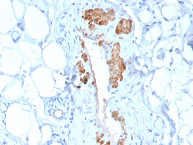 Smooth Muscle Myosin Heavy Chain (SM-MHC) Antibody in Immunohistochemistry (Paraffin) (IHC (P))