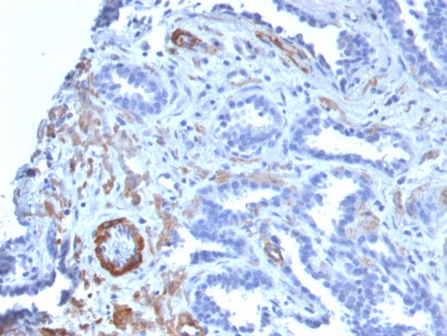 Smooth Muscle Myosin Heavy Chain (SM-MHC) Antibody in Immunohistochemistry (Paraffin) (IHC (P))