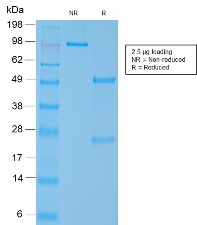 Smooth Muscle Myosin Heavy Chain (SM-MHC) Antibody in SDS-PAGE (SDS-PAGE)