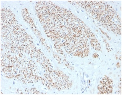 Smooth MuscleMyosin Heavy Chain (SM-MHC) (Leiomyosarcoma and Myoepithelial Cell Marker) Antibody in Immunohistochemistry (Paraffin) (IHC (P))