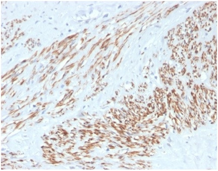 Smooth MuscleMyosin Heavy Chain (SM-MHC) (Leiomyosarcoma and Myoepithelial Cell Marker) Antibody in Immunohistochemistry (Paraffin) (IHC (P))