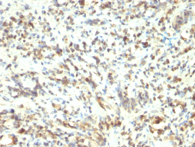 MyoD1 (Rhabdomyosarcoma Marker) Antibody in Immunohistochemistry (Paraffin) (IHC (P))