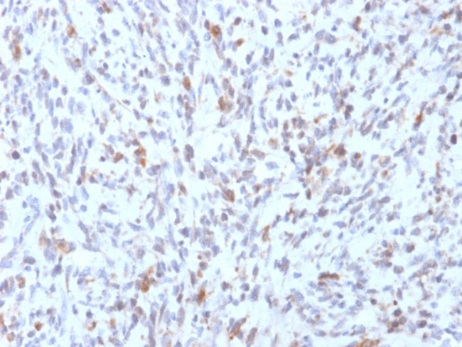 MyoD1 Antibody in Immunohistochemistry (Paraffin) (IHC (P))