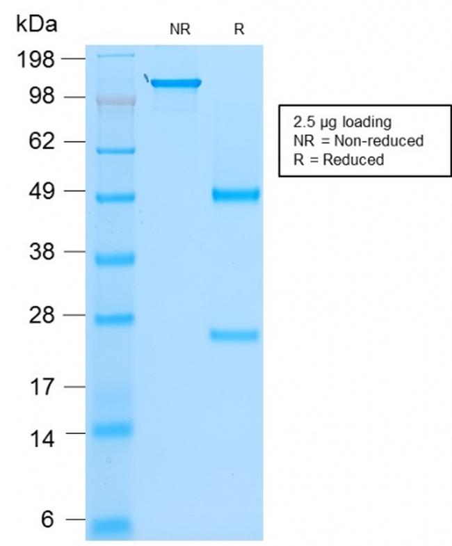 MyoD1 Antibody in SDS-PAGE (SDS-PAGE)