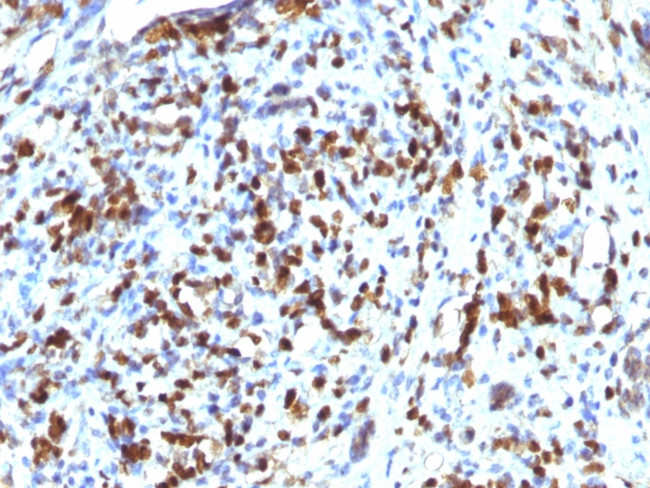 MyoD1 Antibody in Immunohistochemistry (Paraffin) (IHC (P))