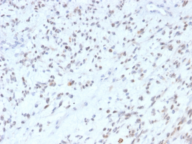 MyoD1 Antibody in Immunohistochemistry (Paraffin) (IHC (P))