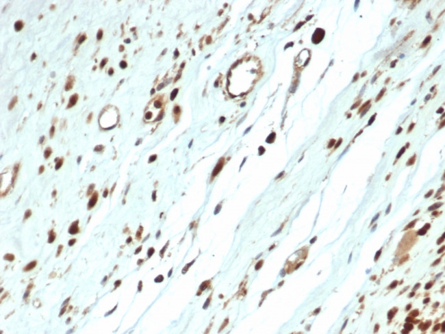 MyoD1 Antibody in Immunohistochemistry (Paraffin) (IHC (P))