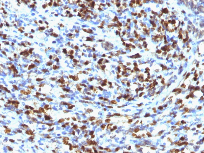 Myogenin/Myf-4 Antibody in Immunohistochemistry (Paraffin) (IHC (P))