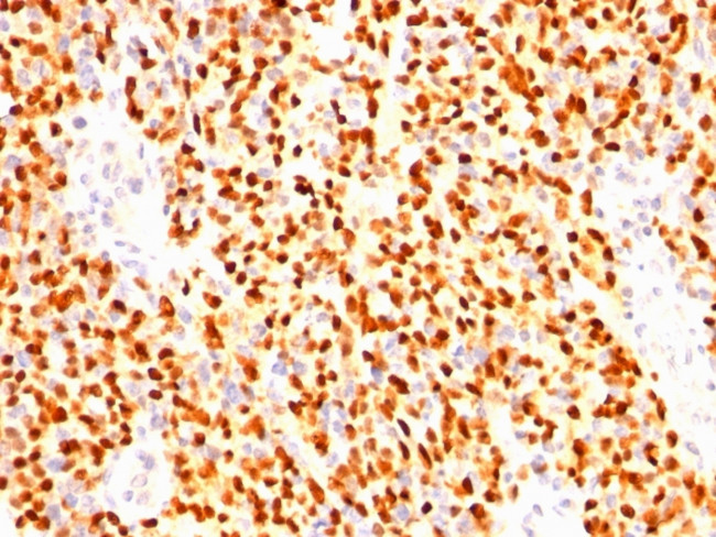 Myogenin/Myf-4 (Skeletal Muscle Marker) Antibody in Immunohistochemistry (Paraffin) (IHC (P))