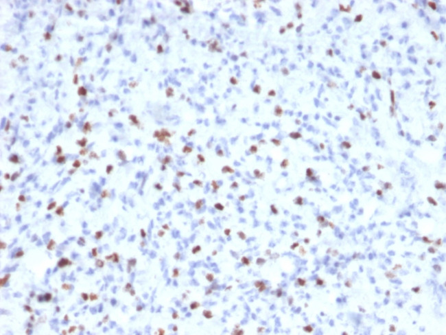 Myogenin/Myf-4 (Skeletal Muscle Marker) Antibody in Immunohistochemistry (Paraffin) (IHC (P))