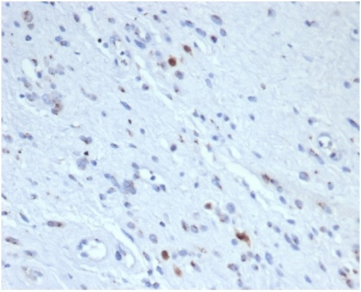 Myogenin/Myf-4 (Skeletal Muscle Marker) Antibody in Immunohistochemistry (Paraffin) (IHC (P))