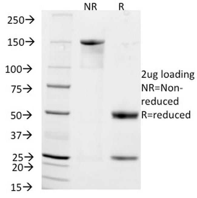 CD56/NCAM1/NKH1 Antibody in SDS-PAGE (SDS-PAGE)