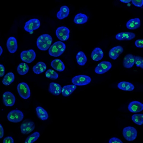 Nucleolin Antibody in Immunocytochemistry (ICC/IF)