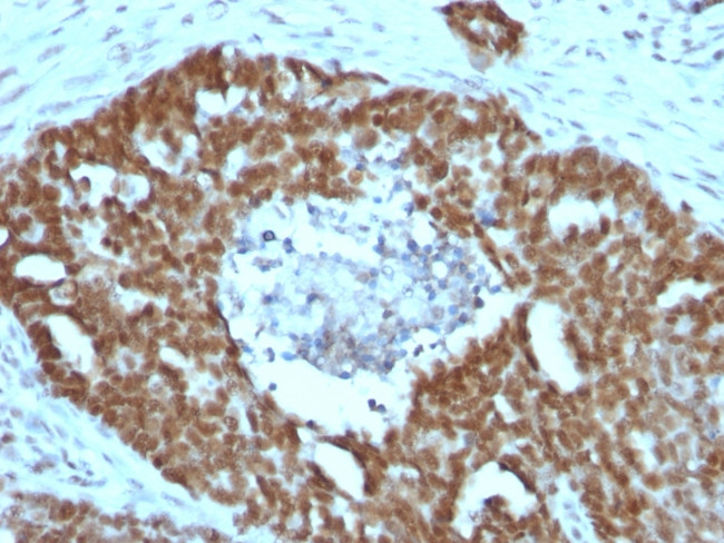 Nucleolin Antibody in Immunohistochemistry (Paraffin) (IHC (P))