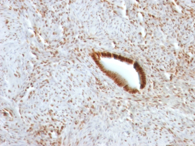 Nucleolin Antibody in Immunohistochemistry (Paraffin) (IHC (P))