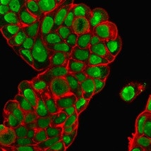 Nucleolin (Marker of Human Cells) Antibody in Immunocytochemistry (ICC/IF)