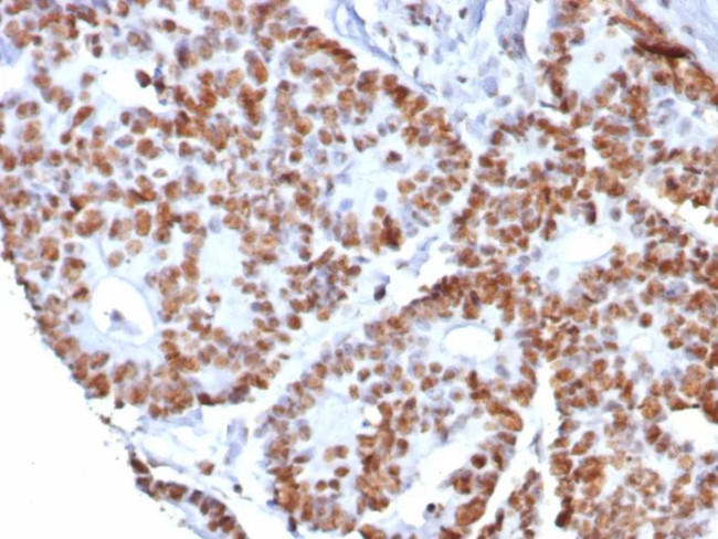 Nucleolin (Marker of Human Cells) Antibody in Immunohistochemistry (Paraffin) (IHC (P))