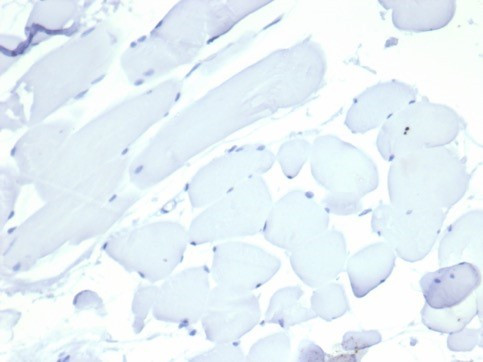 Nucleolin (Marker of Human Cells) Antibody in Immunohistochemistry (Paraffin) (IHC (P))