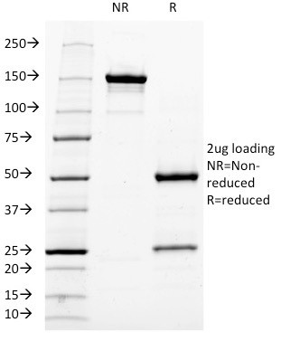 Neurofilament (NF-H) (Neuronal Marker) Antibody in SDS-PAGE (SDS-PAGE)