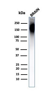 Neurofilament (NF-H) (Neuronal Marker) Antibody in Western Blot (WB)