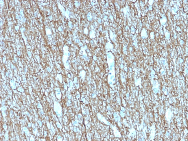 Neurofilament Antibody in Immunohistochemistry (Paraffin) (IHC (P))