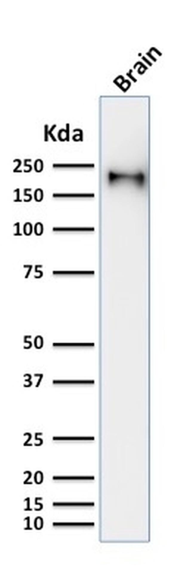 Neurofilament Antibody in Western Blot (WB)