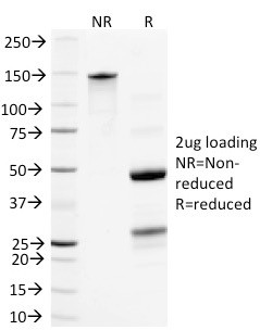 Neurofilament (NF-L) (Neuronal Marker) Antibody in SDS-PAGE (SDS-PAGE)