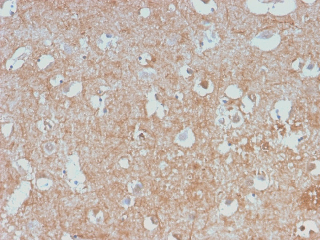 Neurofilament (NF-L) Antibody in Immunohistochemistry (Paraffin) (IHC (P))