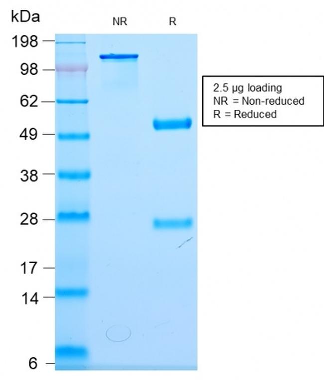 Neurofilament (NF-L) Antibody in SDS-PAGE (SDS-PAGE)