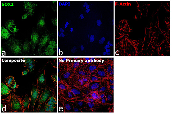 SOX2 Antibody in Immunocytochemistry (ICC/IF)