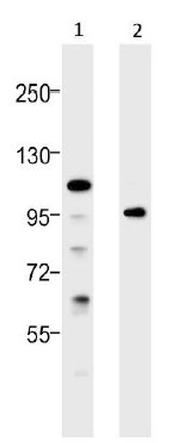 TLR4 Antibody in Western Blot (WB)