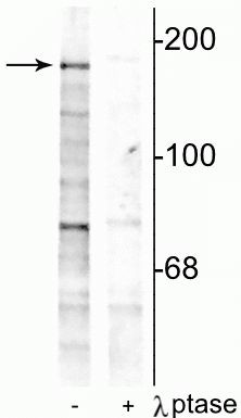 Phospho-NMDAR2B (Tyr1252) Antibody in Western Blot (WB)