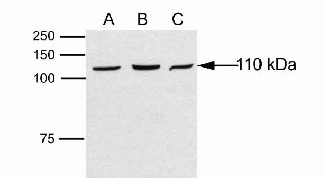 DAB2IP Antibody in Western Blot (WB)