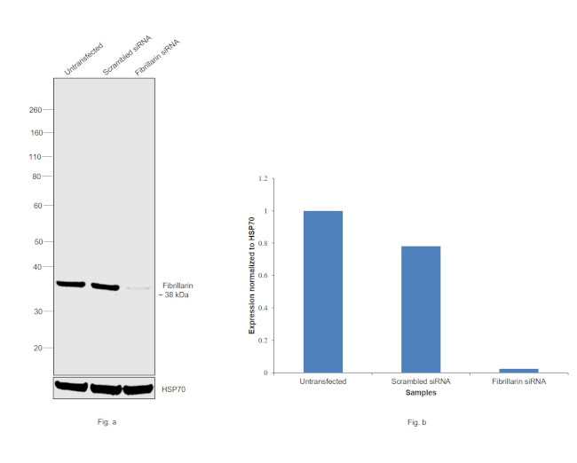 Fibrillarin Antibody