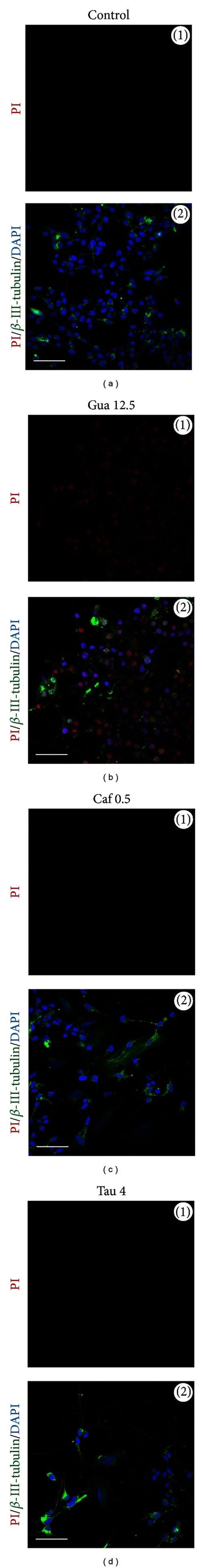 beta Tubulin Antibody in Immunocytochemistry (ICC/IF)