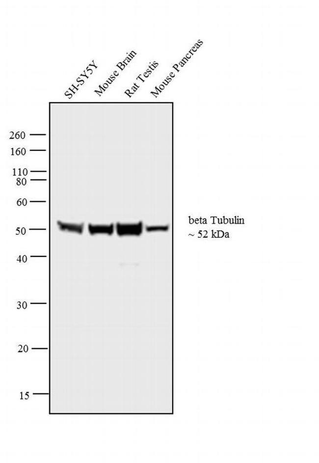 beta Tubulin Antibody in Western Blot (WB)