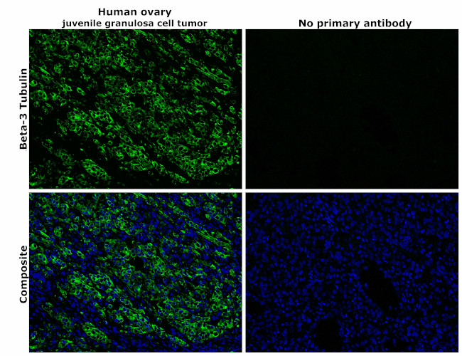 beta Tubulin Antibody in Immunohistochemistry (Paraffin) (IHC (P))