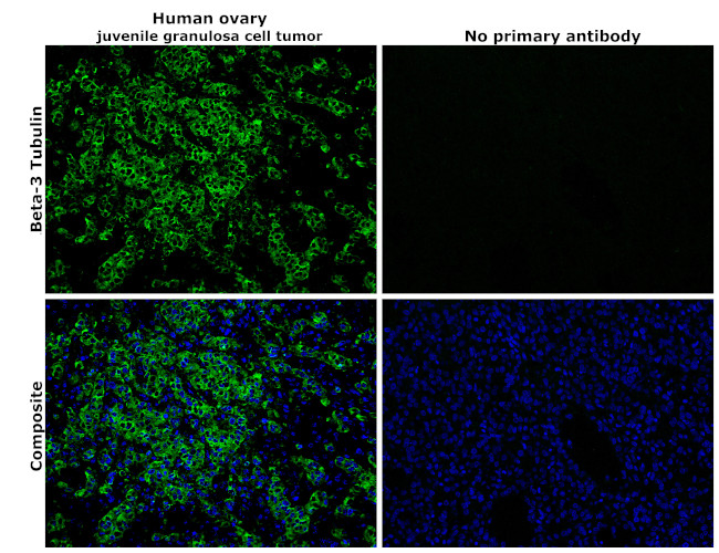 beta Tubulin Antibody in Immunohistochemistry (Paraffin) (IHC (P))