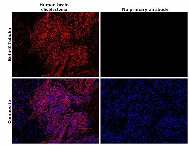 beta Tubulin Antibody in Immunohistochemistry (Paraffin) (IHC (P))