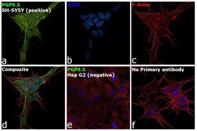 PGP9.5 Antibody in Immunocytochemistry (ICC/IF)