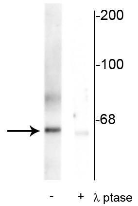 Phospho-PLK1 (Thr210) Antibody in Western Blot (WB)