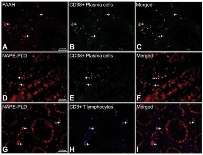 CD3 Antibody in Immunohistochemistry (IHC)