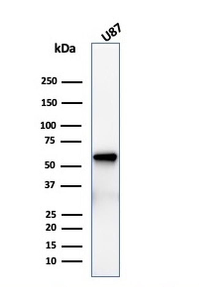 NGF-Receptor (p75)/CD271 Antibody in Western Blot (WB)