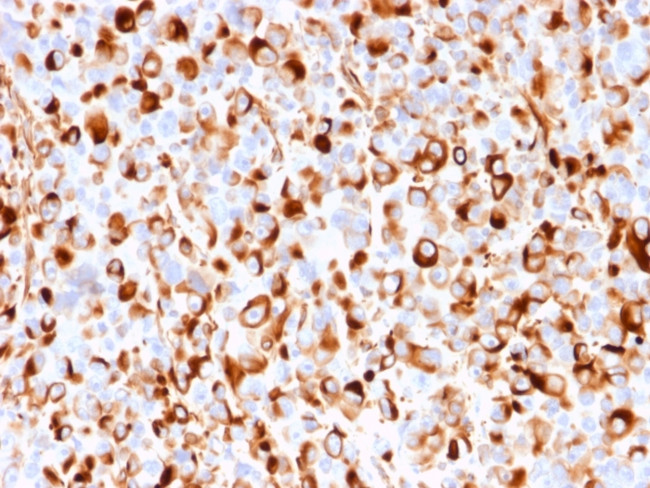 NGF-Receptor (p75)/CD271 Antibody in Immunohistochemistry (Paraffin) (IHC (P))