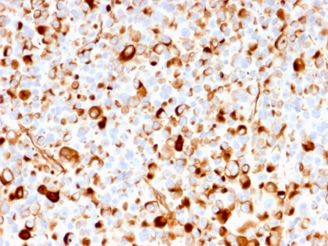 NGF-Receptor (p75)/CD271 Antibody in Immunohistochemistry (Paraffin) (IHC (P))